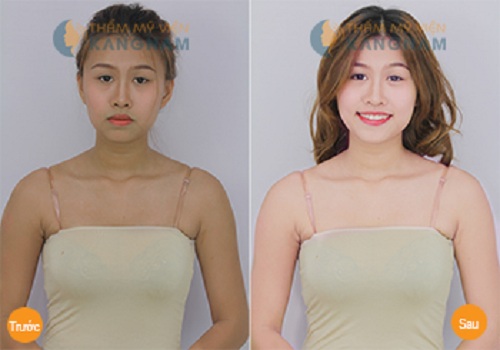 tắm trắng bằng hoa quả