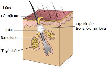 tai-sao-can-tay-da-chet-truoc-khi-tam-trang-2