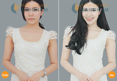 tam-trang-1-lan-da-dep-mai4